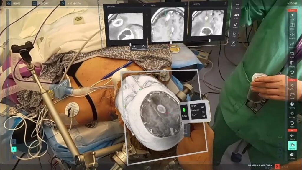 Medivis - Leveraging AR technology for efficient surgical planning