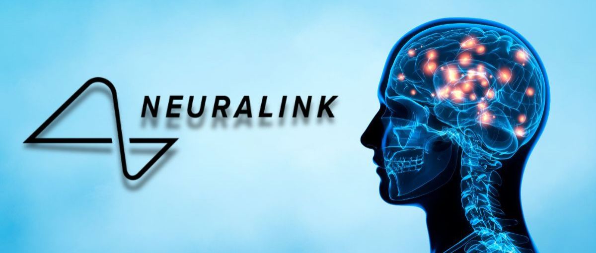 Brain-Computer Interfaces: Neuralink Joins the Game—but the Field Is Crowded